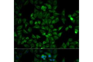 Immunofluorescence analysis of HeLa cells using TPI1 Polyclonal Antibody (TPI1 antibody)