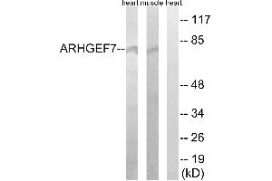 Western blot analysis of extracts from rat muscle cells and rat heart cells, using ARHGEF7 antibody. (ARHGEF7 antibody  (Internal Region))