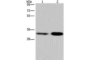 Western Blot analysis of Jurkat and NIH/3T3 cell using CDK5 Polyclonal Antibody at dilution of 1:300 (CDK5 antibody)