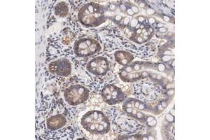 Immunohistochemical staining of human small intestine with SETD3 polyclonal antibody  shows moderate cytoplasmic positivity in glandular cells. (SETD3 antibody)