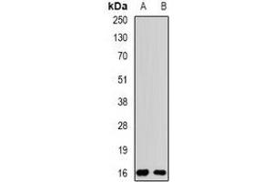 Western blot analysis of Rpp20 expression in MCF7 (A), SW480 (B) whole cell lysates. (POP5 antibody)