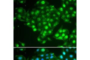 Immunofluorescence analysis of HeLa cells using ABCA3 Polyclonal Antibody (ABCA3 antibody)