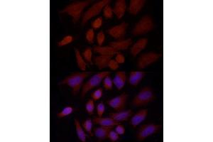 Immunofluorescence analysis of HeLa cells using SREBF1 Rabbit pAb (ABIN7270598) at dilution of 1:100 (40x lens). (SREBF1 antibody  (AA 1-100))