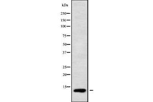 Western blot analysis SEC61B using COLO205 whole cell lysates (SEC61B antibody  (N-Term))