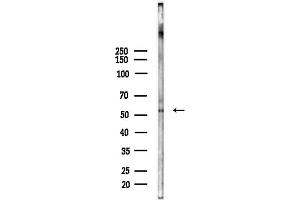 Western blot analysis of lysates from HUVEC cells(heat-shock,45 min treatment), using CHRN Antibody at 1/1000 dilution.