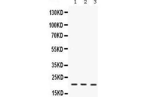 Western blot analysis of IL7 expression in mouse brain extract (lane 1), mouse thymus extract (lane 2) and NIH3T3 whole cell lysates (lane 3).