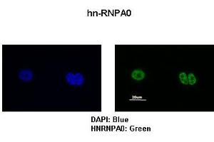 Sample Type :  MCF7 cells   Primary Antibody Dilution :   1:200   Secondary Antibody:  Anti-rabbit-FITC   Secondary Antibody Dilution:   1:500   Color/Signal Descriptions:  DAPI: Blue hn-RNPA0: Green   Gene Name:  HNRPA0   Submitted by:  Anonymous (HNRNPA0 antibody  (Middle Region))