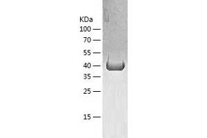 KRT20 Protein (AA 2-424) (His tag)