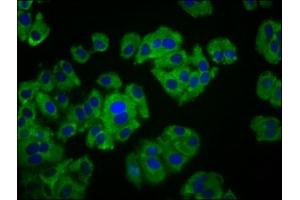 Immunofluorescence staining of HepG2 cells with ABIN7165474 at 1:133, counter-stained with DAPI. (ITFG3 antibody  (AA 115-251))