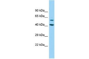 Host: Rabbit Target Name: DEPDC1B Sample Type: 293T Whole Cell lysates Antibody Dilution: 1. (DEPDC1B antibody  (N-Term))