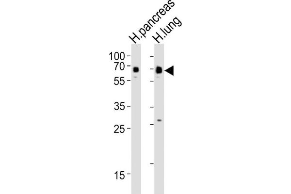 SSTR1 antibody  (C-Term)