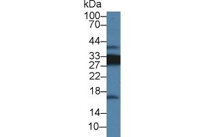 Detection of CD74 in Rat Spleen lysate using Polyclonal Antibody to Cluster Of Differentiation 74 (CD74) (CD74 antibody  (AA 65-277))