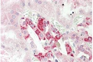 Human Kidney: Formalin-Fixed, Paraffin-Embedded (FFPE) (CUTA antibody  (AA 71-120))