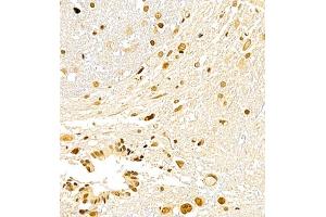 Immunohistochemistry of paraffin embedded rat spinal cord using USP27 (ABIN7076113) at dilution of 1:700 (400x lens) (USP27X antibody)