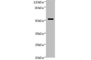 Western blot All lanes: STARD3 Antibody at 6 μg/mL + MCF-7 whole cell lysate Secondary Goat polyclonal to rabbit IgG at 1/10000 dilution Predicted band size: 51, 49, 50 kDa Observed band size: 51 kDa (STARD3 antibody  (AA 170-445))