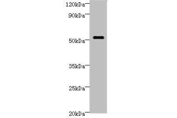 STARD3 anticorps  (AA 170-445)