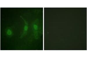 Immunofluorescence analysis of HeLa cells, using IRF-3 (Phospho-Ser385) Antibody.