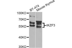 Western blot analysis of extracts of various cell lines, using IKZF3 Antibody (ABIN4904027) at 1:1000 dilution. (IKZF3 antibody)