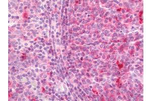 Human Tonsil: Formalin-Fixed, Paraffin-Embedded (FFPE). (HLA-DPA1 antibody  (FITC))