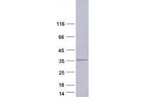 Western Blotting (WB) image for Syndecan Binding Protein (Syntenin) (SDCBP) (Transcript Variant 3) protein (Myc-DYKDDDDK Tag) (ABIN2733117)