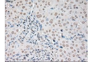 Immunohistochemical staining of paraffin-embedded pancreas tissue using anti-SOX17 mouse monoclonal antibody.