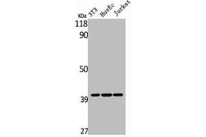 Western Blot analysis of NIH-3T3 HuvEc Jurkat cells using MAGE-C2 Polyclonal Antibody