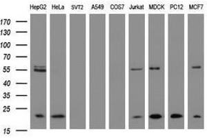 Image no. 3 for anti-NADH Dehydrogenase (Ubiquinone) 1 beta Subcomplex, 9, 22kDa (NDUFB9) (AA 3-179) antibody (ABIN1491361) (NDUFB9 antibody  (AA 3-179))