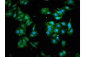 Immunofluorescence staining of HepG2 cells with ABIN7153511 at 1:93, counter-stained with DAPI. (GABARAP antibody  (AA 2-117))