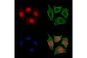 Anillin Antibody staining HepG2 cells by IF/ICC.