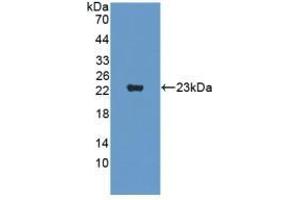 Supervillin antibody  (AA 1385-1525)