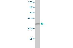 Western Blot detection against Immunogen (35. (TFCP2 antibody  (AA 414-502))
