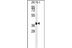 NIL2 Antibody (N-term) (ABIN651598 and ABIN2840315) western blot analysis in ZR-75-1 cell line lysates (35 μg/lane). (NIPAL2 antibody  (N-Term))