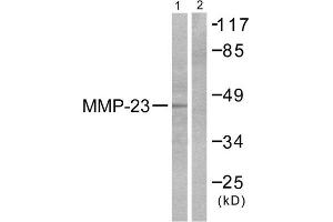 Western Blotting (WB) image for anti-Matrix Metallopeptidase 23 (MMP23) (C-Term) antibody (ABIN1848685) (Matrix Metallopeptidase 23 (MMP23) (C-Term) antibody)