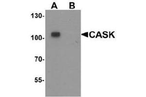 Western blot analysis of CASK in mouse brain tissue lysate with CASK antibody at 1 ug/ml in (A) the absence and (B) the presence of blocking peptide. (CASK antibody  (N-Term))