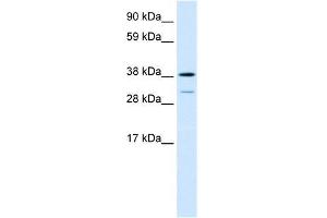Human Lung; WB Suggested Anti-TCFL1 Antibody Titration: 0. (VPS72 antibody  (Middle Region))