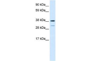 Human Lung; WB Suggested Anti-TCFL1 Antibody Titration: 0. (VPS72 antibody  (Middle Region))