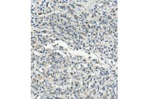 IHC analysis of UBE3A using anti-UBE3A antibody (ABIN7599562). (ube3a antibody  (AA 1-860))
