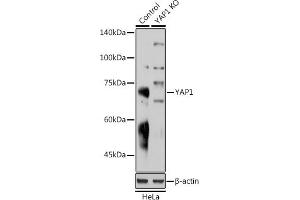 Western blot analysis of extracts from normal (control) and Y Rabbit pAb knockout (KO) HeLa cells, using Y Rabbit pAb antibody (ABIN6132788, ABIN6150316, ABIN6150321 and ABIN6215135) at 1:1000 dilution. (YAP1 antibody  (AA 155-504))