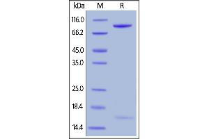 Human PCSK9, Fc Tag on  under reducing (R) condition. (PCSK9 Protein (AA 31-692) (Fc Tag))