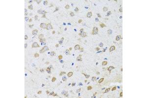 Immunohistochemistry of paraffin-embedded mouse brain using ARL6 antibody at dilution of 1:100 (x40 lens). (ARL6 antibody)
