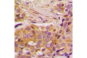 Immunohistochemistry (IHC) image for anti-SRSF Protein Kinase 1 (SRPK1) antibody (ABIN7308374) (SRPK1 antibody)