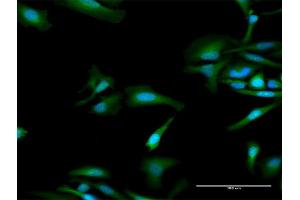 Immunofluorescence of purified MaxPab antibody to OAS1 on HeLa cell. (OAS1 antibody  (AA 1-364))