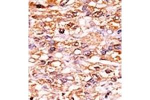Immunohistochemistry (Paraffin-embedded Sections) (IHC (p)) image for anti-Cyclin-Dependent Kinase Inhibitor 1B (p27, Kip1) (CDKN1B) (pSer178) antibody (ABIN389615)