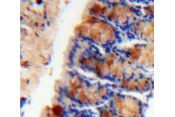 Urocortin 1 antibody  (AA 34-120)