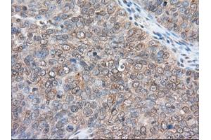 Immunohistochemical staining of paraffin-embedded Human liver tissue using anti-RANGAP1 mouse monoclonal antibody. (RANGAP1 antibody)