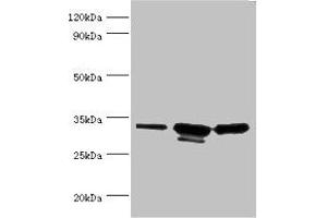Western blot All lanes: CAPZB antibody at 6 μg/mL Lane 1: 293T whole cell lysate Lane 2: A431 whole cell lysate Lane 3: Jurkat whole cell lysate Secondary Goat polyclonal to rabbit IgG at 1/10000 dilution Predicted band size: 32, 31 kDa Observed band size: 32, 31 kDa (CAPZB antibody  (AA 1-272))