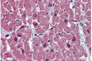 Human Heart: Formalin-Fixed, Paraffin-Embedded (FFPE)