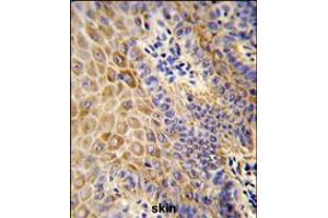 Formalin-fixed and paraffin-embedded human Skin reacted with GC Antibody , which was peroxidase-conjugated to the secondary antibody, followed by DAB staining. (Gc (AA 337-365) antibody)