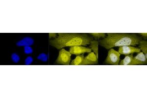 Immunocytochemistry/Immunofluorescence analysis using Rabbit Anti-Phosphoserine Polyclonal Antibody (ABIN361725). (Phosphoserine antibody)