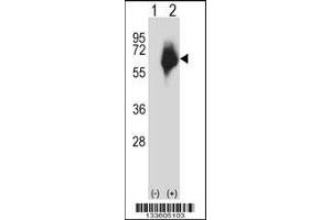 Western blot analysis of MMP2 using rabbit polyclonal MMP2 Antibody using 293 cell lysates (2 ug/lane) either nontransfected (Lane 1) or transiently transfected (Lane 2) with the MMP2 gene. (MMP2 antibody  (AA 303-331))